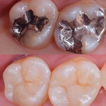 dentistica